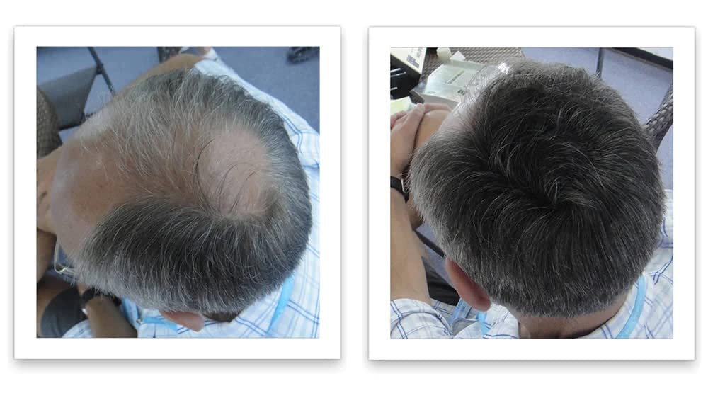Caboki Hair Loss Concealer fine texture powder highlights natural appearance on thinning areas.