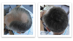 Caboki Hair Loss Concealer fine texture powder highlights natural appearance on thinning areas.