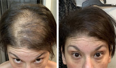 Caboki concealer plant based formula with Levant cotton fibers.