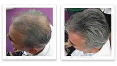 Caboki Hair Loss Concealer thickening effect creates denser-root appearance.