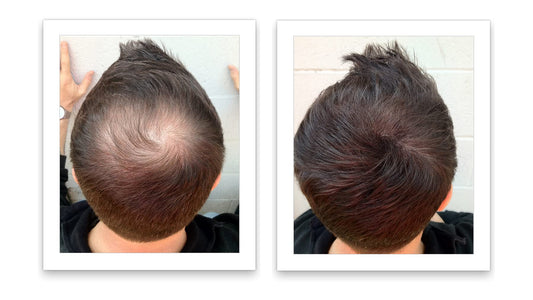 Caboki concealer widens the hair part with seamless texture.