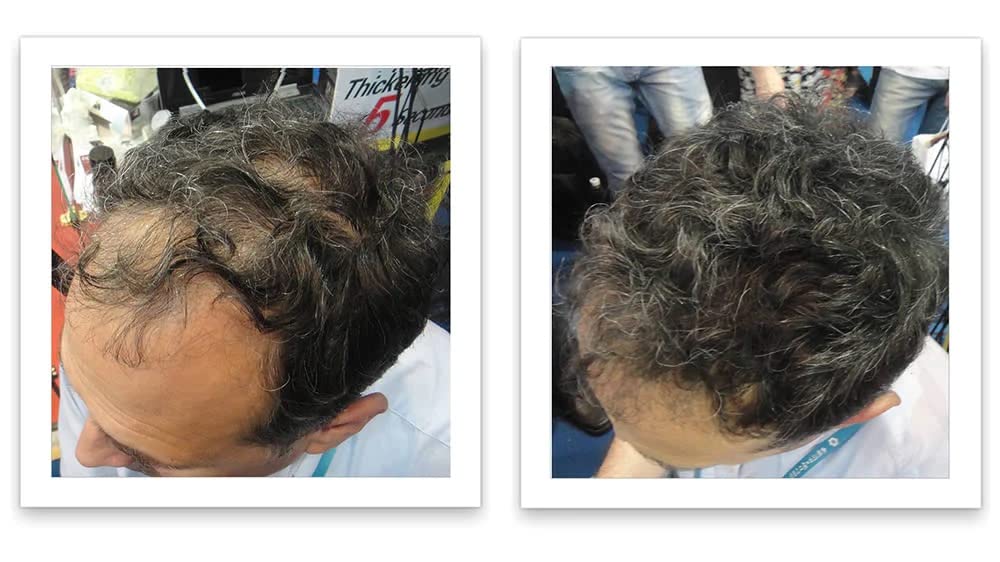 Caboki natural-look fiber blend creates seamless coverage for thinning hair.