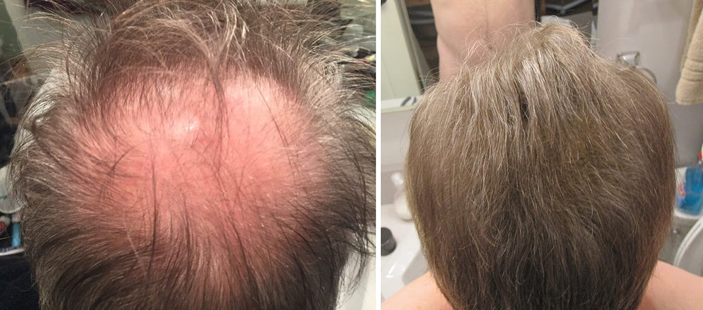 Caboki leaves no greasy or chalky residue on hair