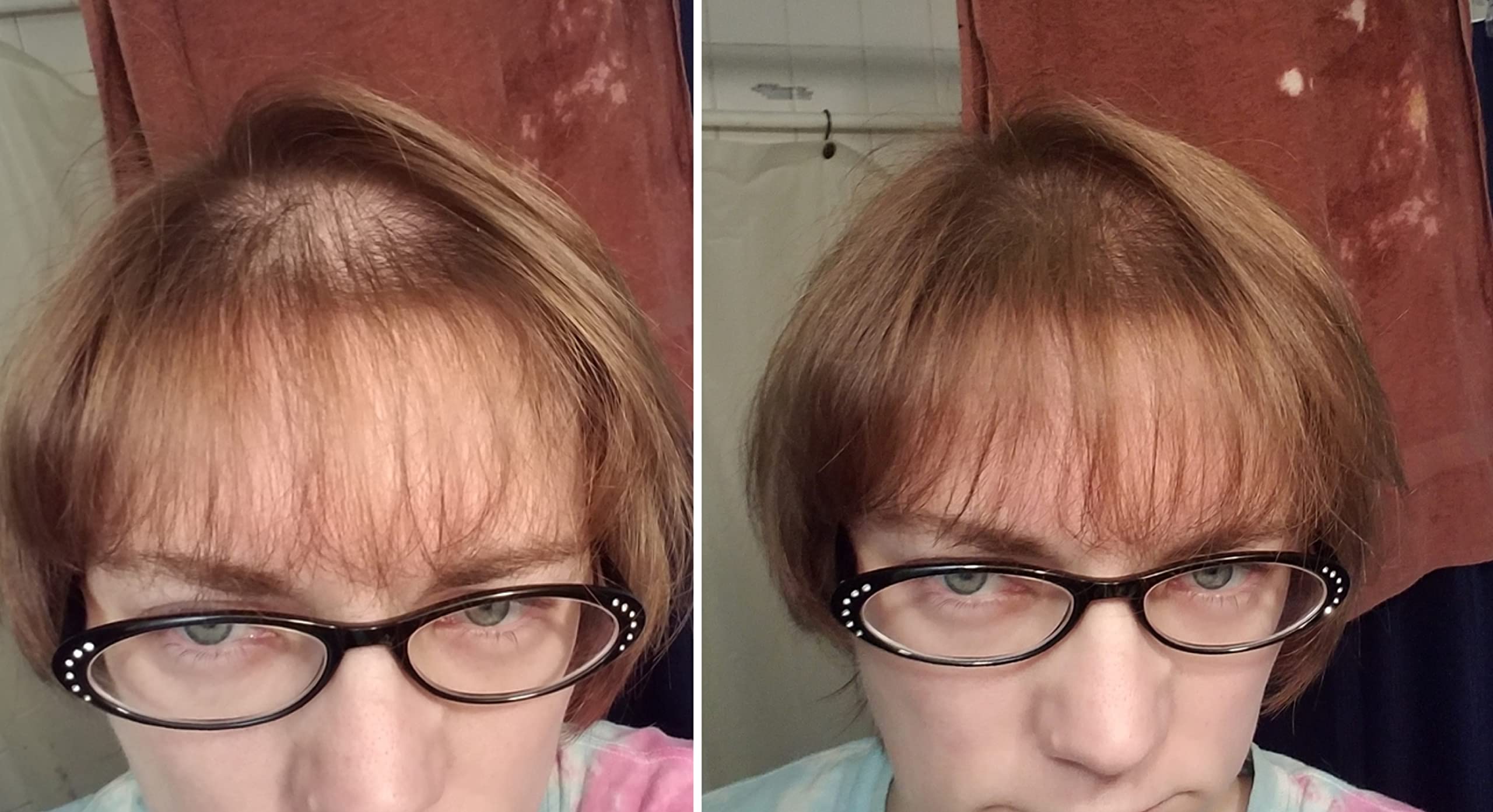 Caboki helps widen hair part for a fuller appearance