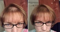 Caboki helps widen hair part for a fuller appearance