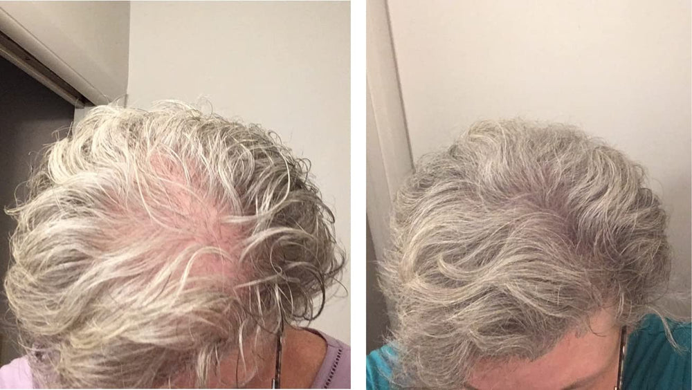 Caboki thinning hair before and after close-up highlights added volume.