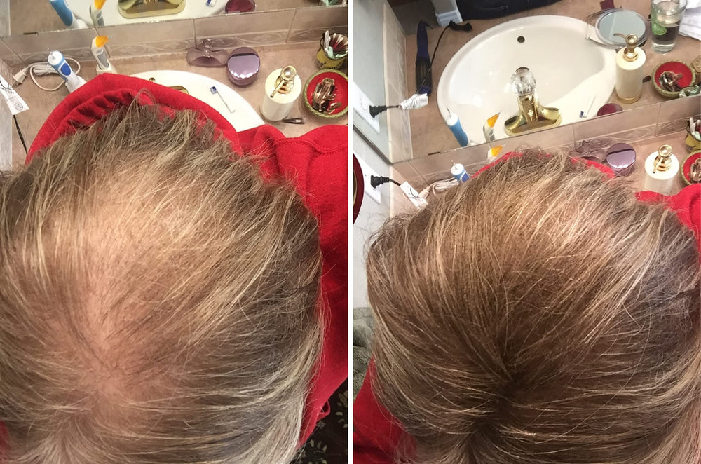 Caboki fibers make thinning hair look fuller and denser