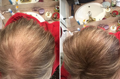 Caboki fibers make thinning hair look fuller and denser
