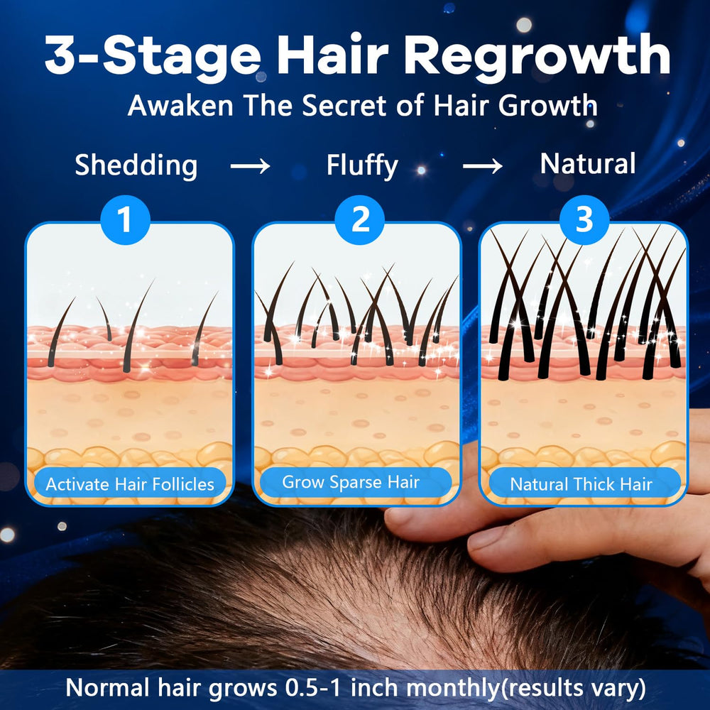 CARENICE Biotin-infused Minoxidil Foam label highlights added hair-supporting biotin.