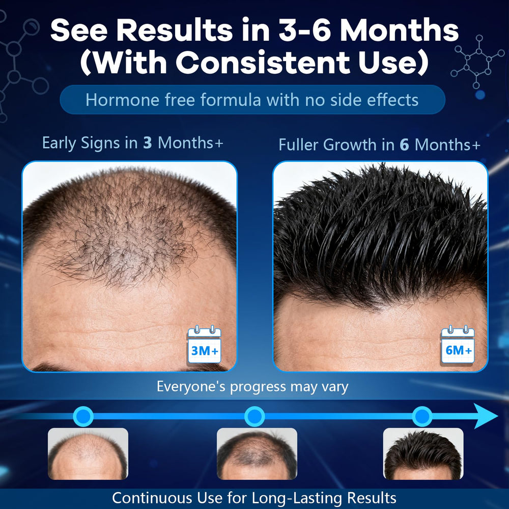 CARENICE Complete hair revitalization system complements your routine.