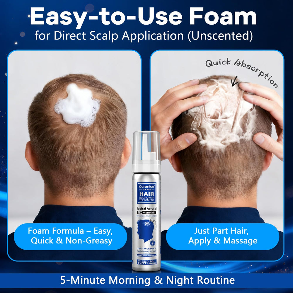 CARENICE Minoxidil Foam for beard application, discreet daily use.