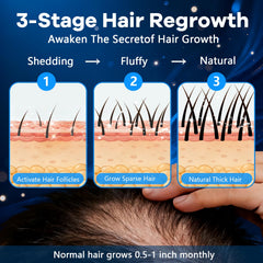 CARENICE Minoxidil Foam applied to beard area for grooming and fullness.