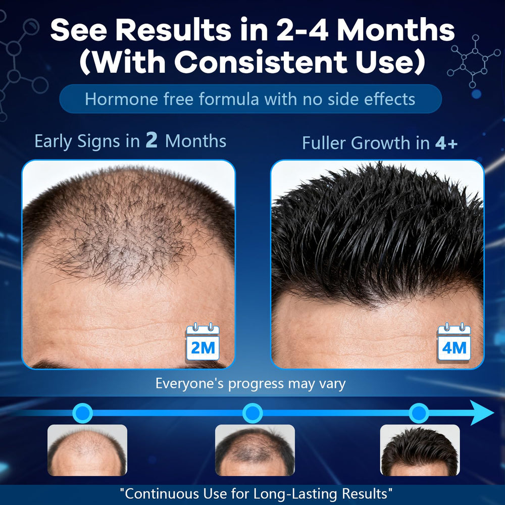 CARENICE Minoxidil Foam packaging close-up shows unscented formula.