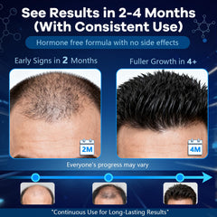 CARENICE Minoxidil Foam packaging close-up shows unscented formula.