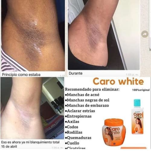 Caro White Set-3 lotion bottle pump demonstrates quick moisture delivery for all skin types.