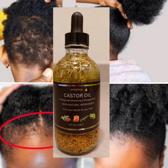Castor Oil Hair Growth 4 oz bottle is travel-friendly.