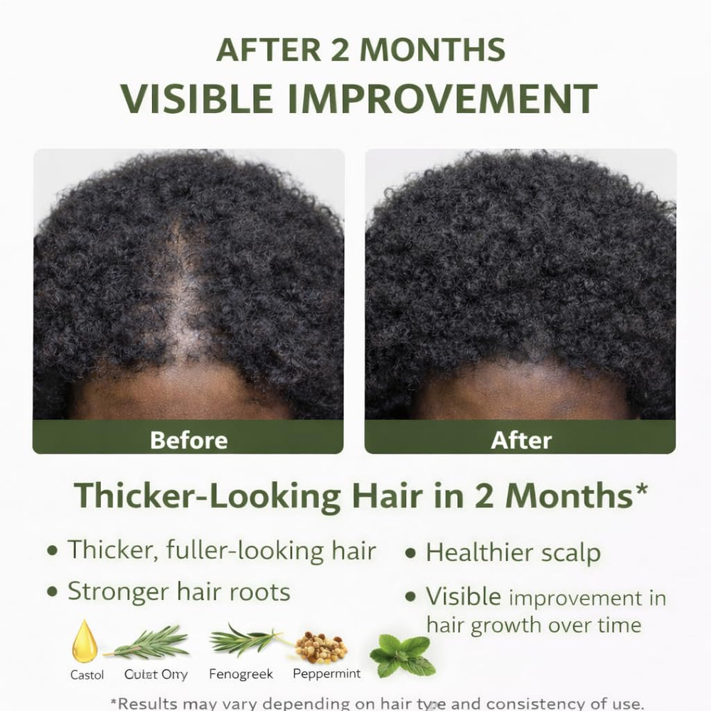 Castor Oil Hair Growth supports all hair types.