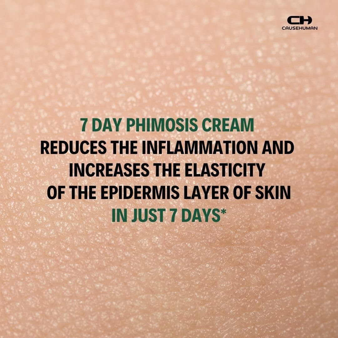 Cause Human 7-Day Phimosis Cream tube closeup highlighting gentle, steroid-free formula