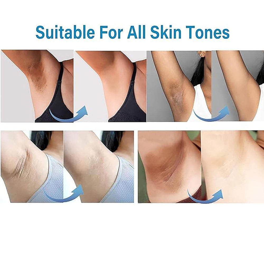 Ceavo Skin Whitening Cream private area application for discreet care