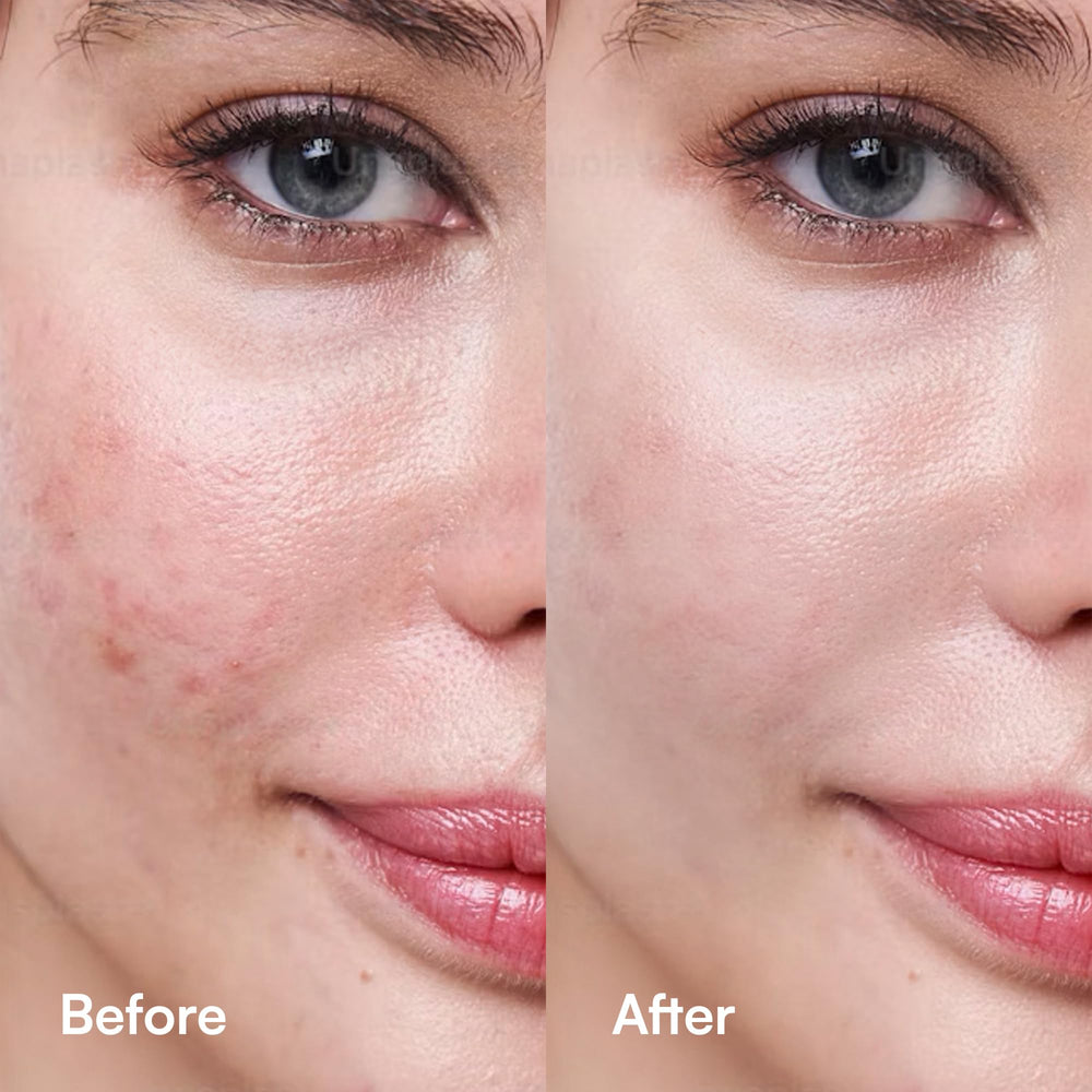 Celement serum on skin showing fast-absorbing non-greasy finish.