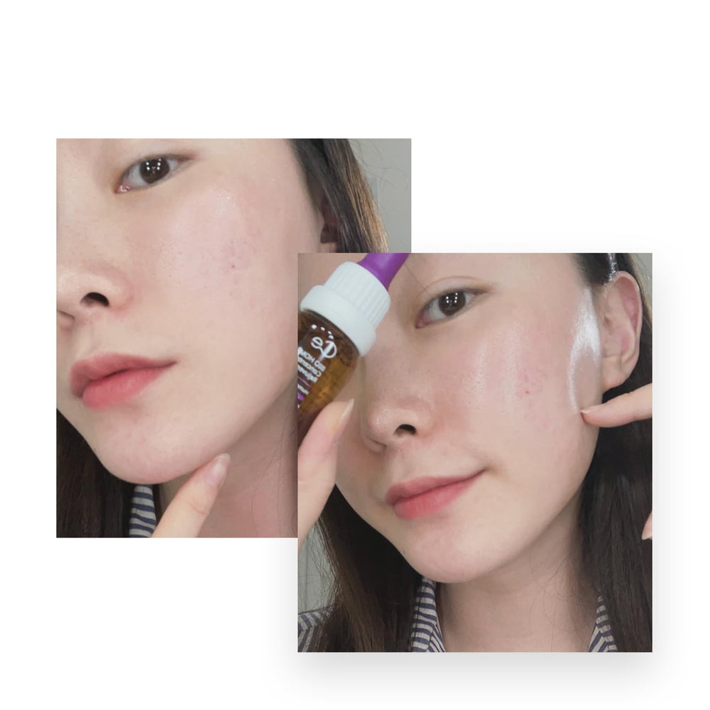 CELONIA Bio Home Solution targets fine lines and acne scars.