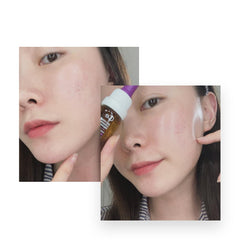 CELONIA Bio Home Solution targets fine lines and acne scars.