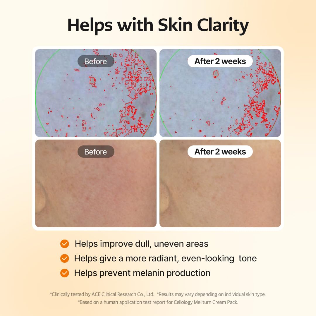 Cellology Meliturn Cream Pack swirled on skin shows smooth, hydrating texture.