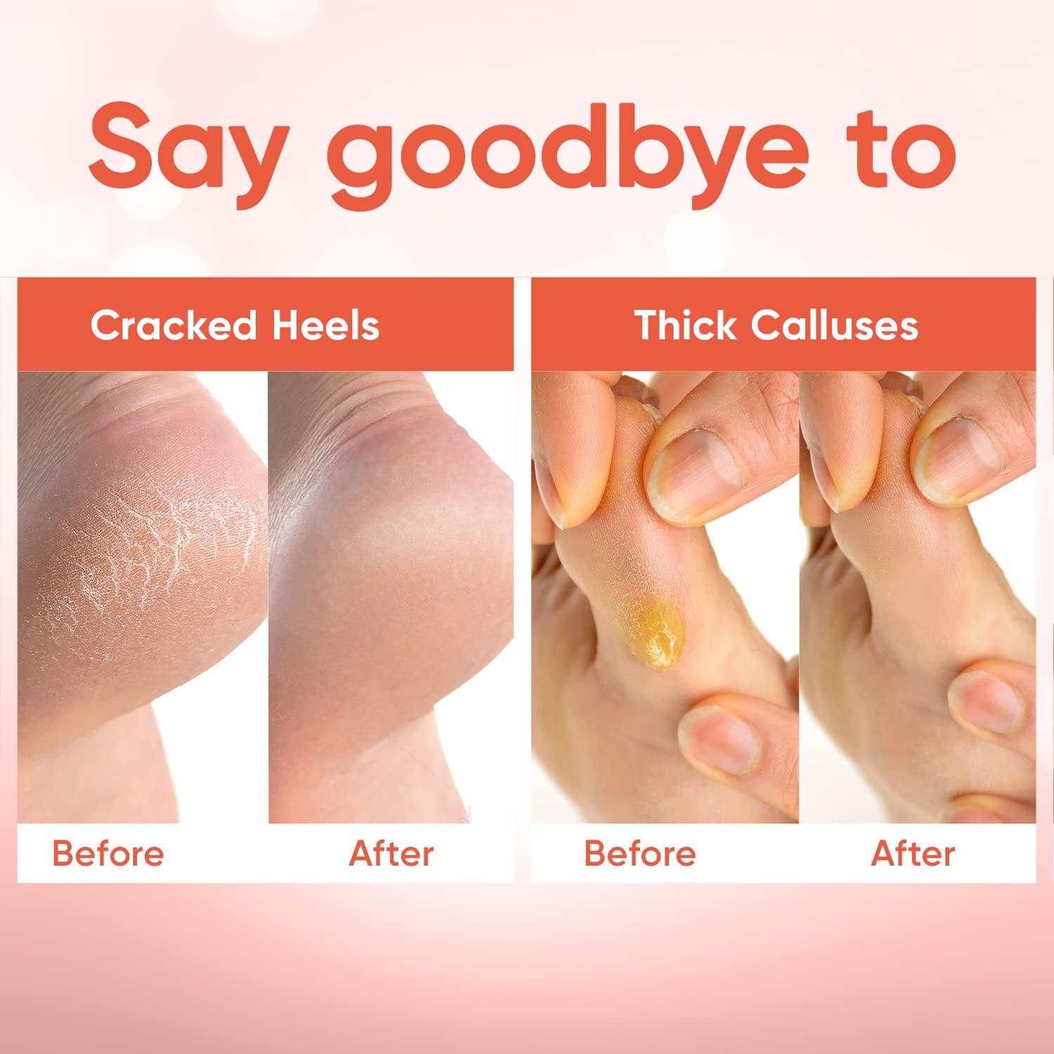 Softened feet with visible glow after using CÉLOR Foot Peel Mask.