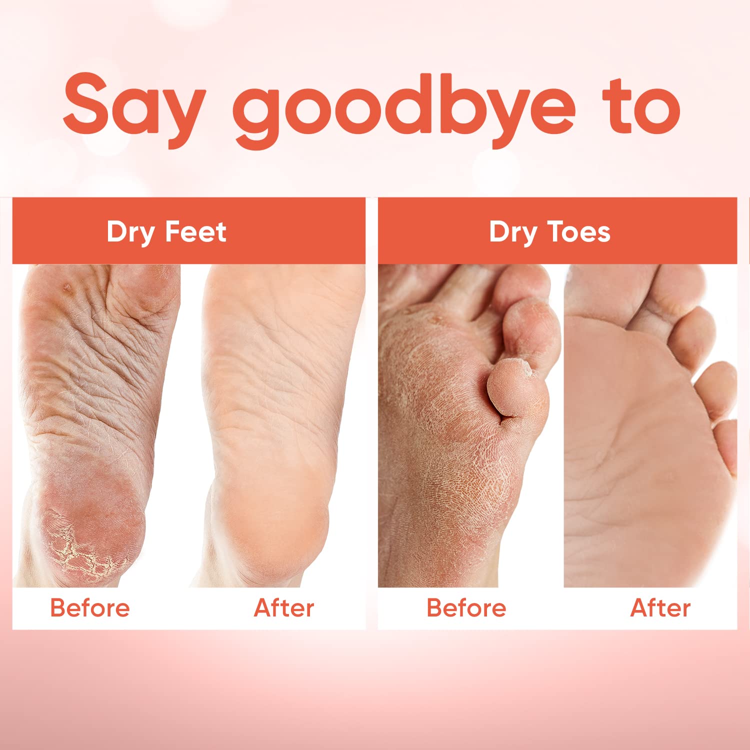 Person wearing CÉLOR booties for easy at-home foot care.