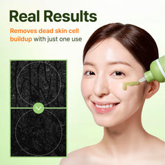 CENTELLIAN 24 charcoal capsules visible in the gel absorb impurities for clearer pores.