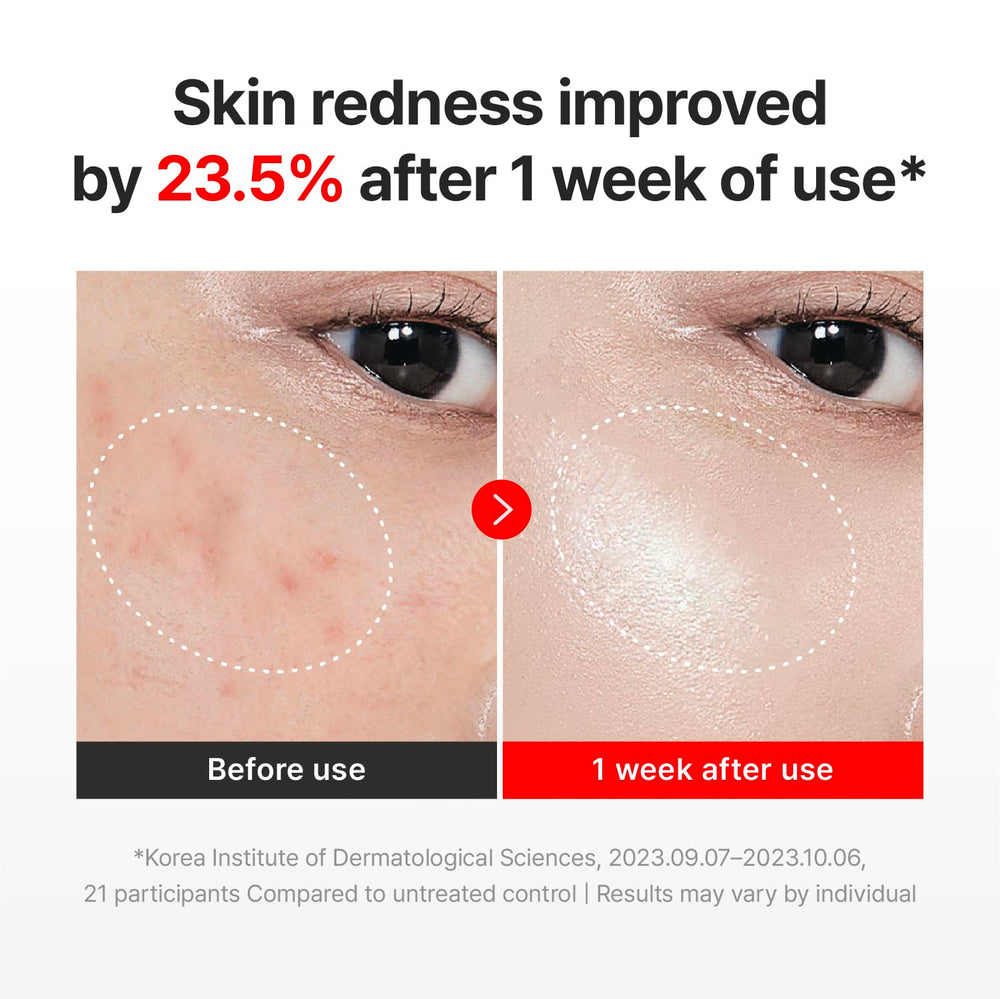 CENTELLIAN24 Madeca Cream Time Reverse TECA 30,000ppm for refined texture