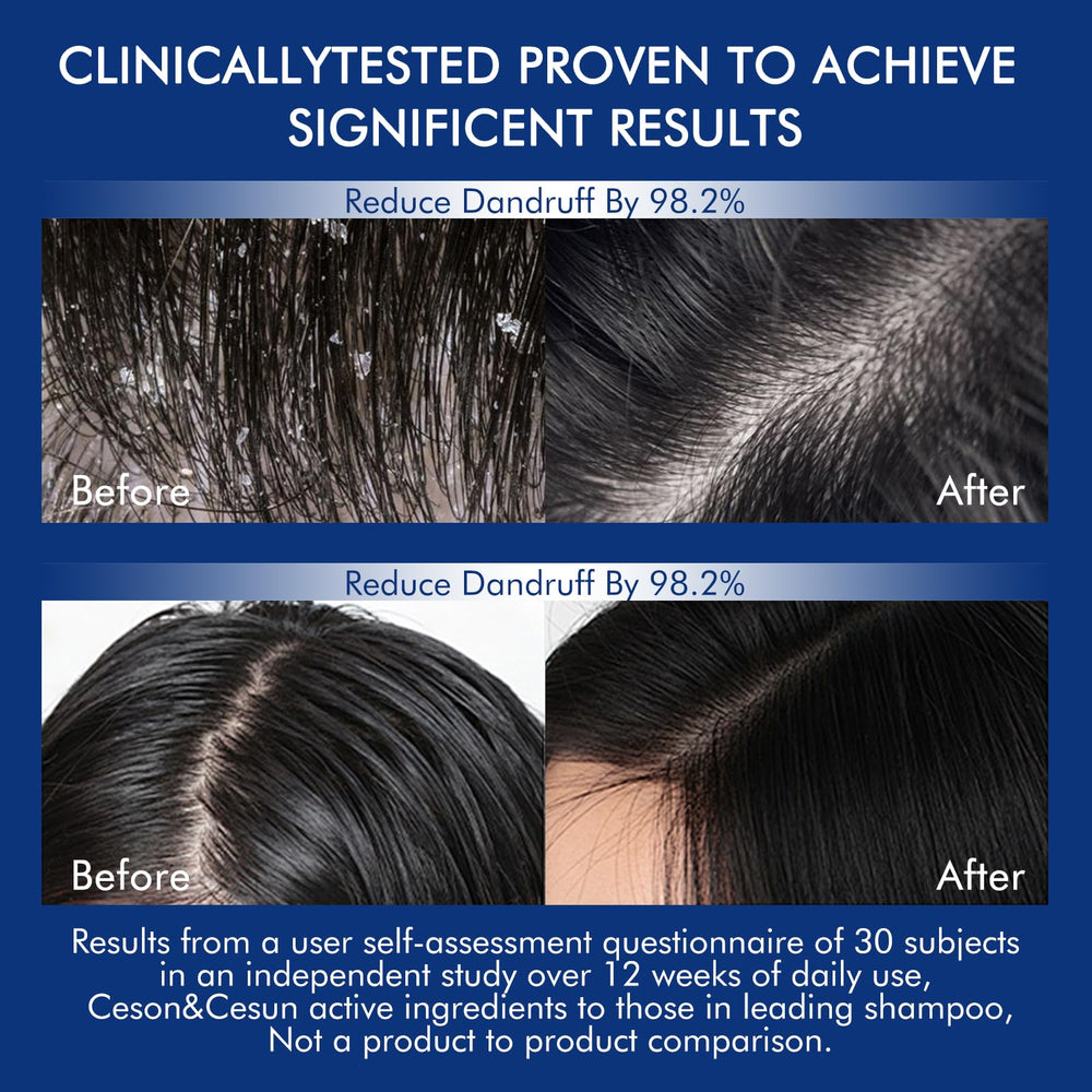 Hair strands appear shinier after Ceson&Cesun rosemary biotin shampoo use