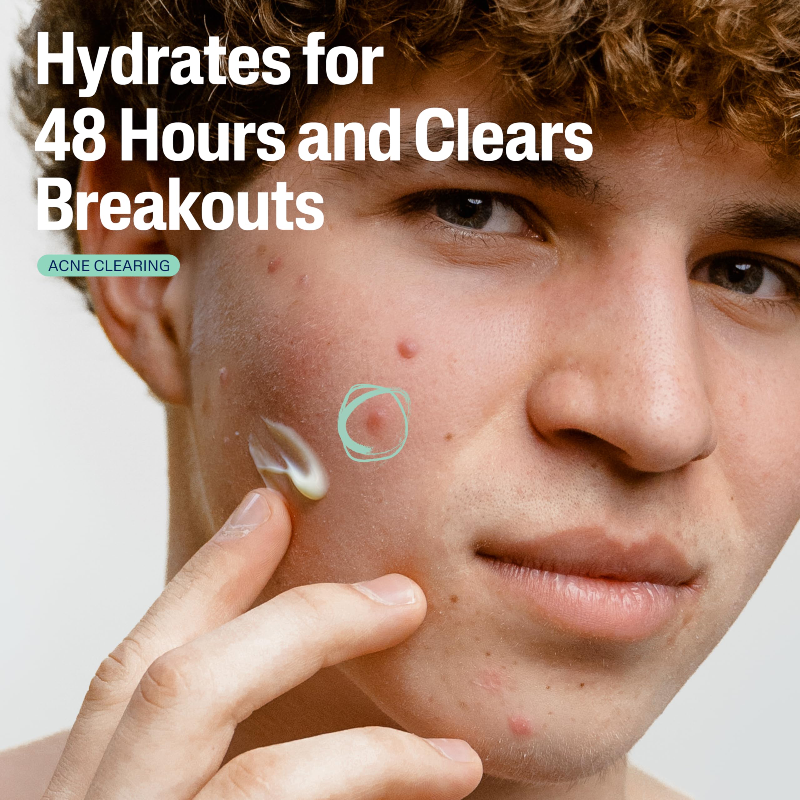 Cetaphil calming botanicals and prebiotic complex nourish acne-prone skin