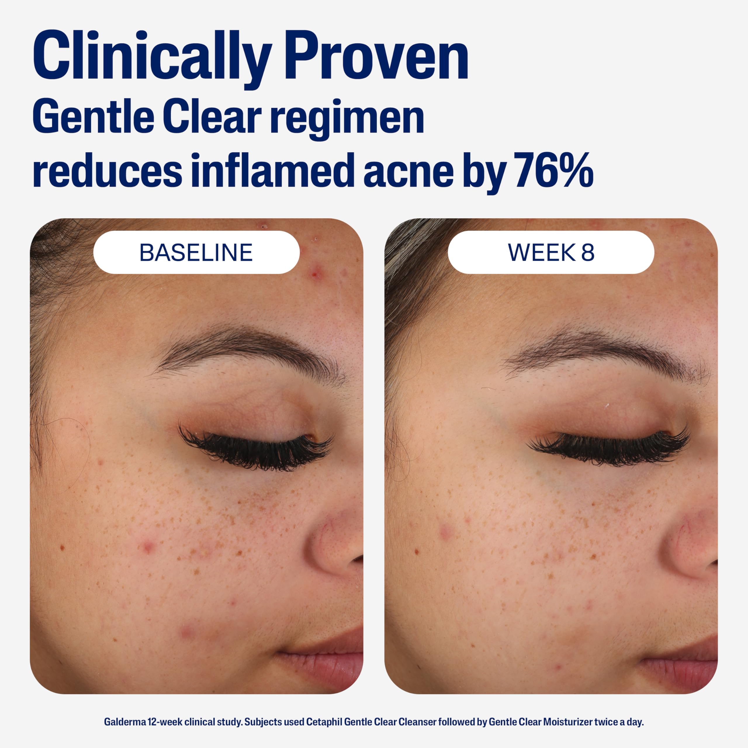 Cetaphil dermatologist-tested moisturizer suitable for sensitive skin