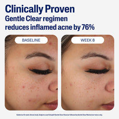 Cetaphil dermatologist-tested moisturizer suitable for sensitive skin