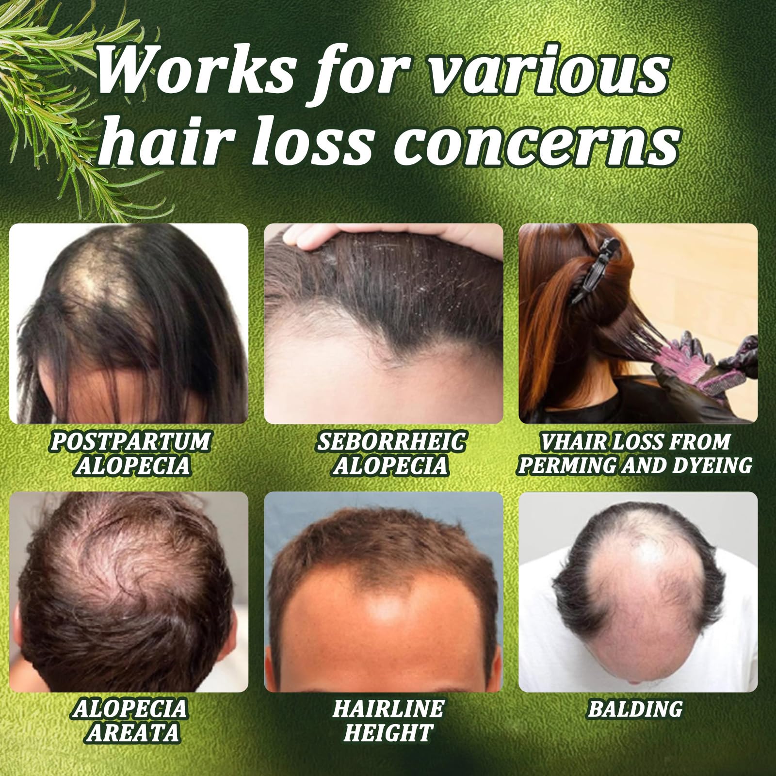 Chambelza Rosemary Shampoo illustrates daily-use, silicone-free cleansing.