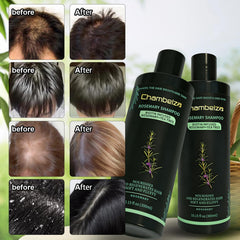 Chambelza Rosemary Shampoo is suitable for men and women with thinning hair.