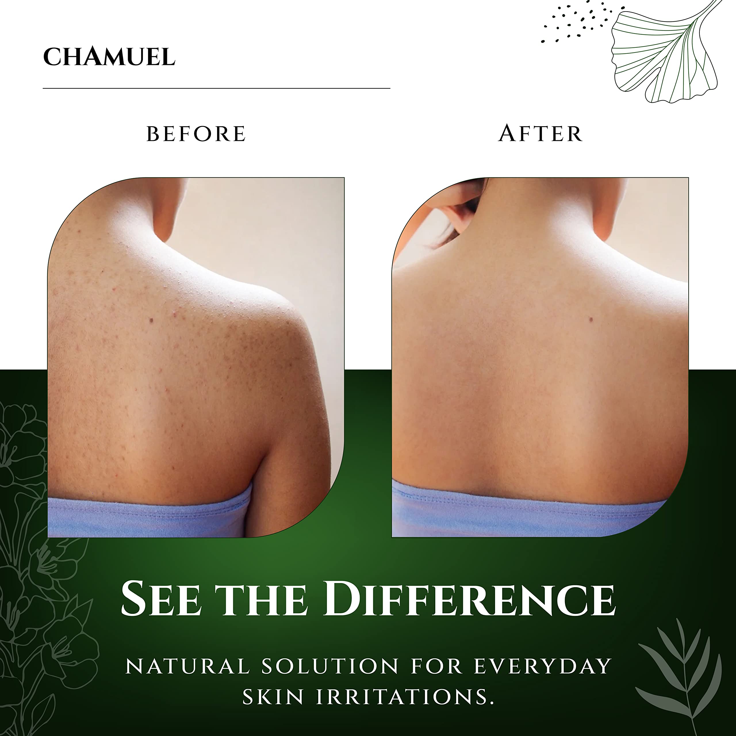 Chamuel Tea Tree Body Wash rich lather close-up for a smooth cleansing experience.