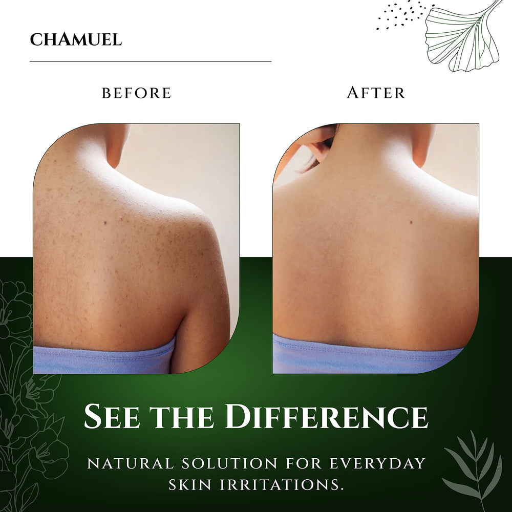 Chamuel Tea Tree Body Wash rich lather close-up for a smooth cleansing experience.