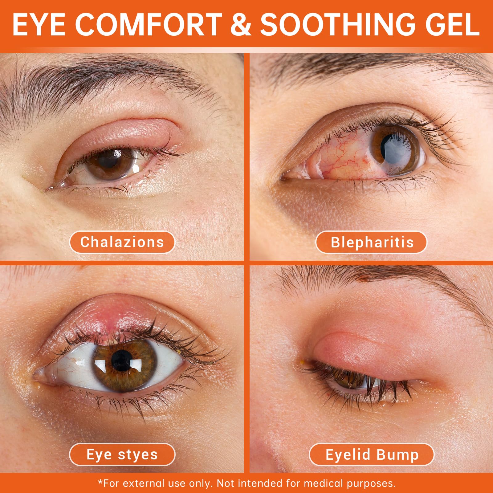 CHANGARLOAD gel with calendula promotes gentle eyelid care.