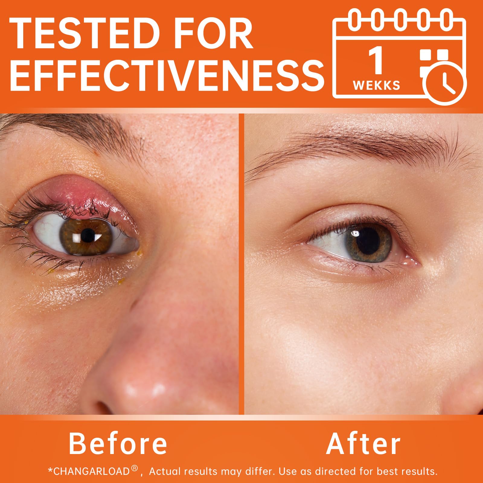 Vitamin E enriched formula supports nourishing skin around the eyes.