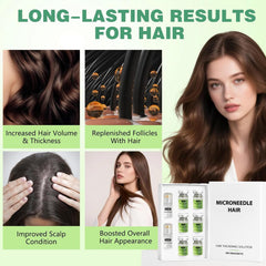 ChLNDalin Alpha Infuse scalp application promotes even absorption.