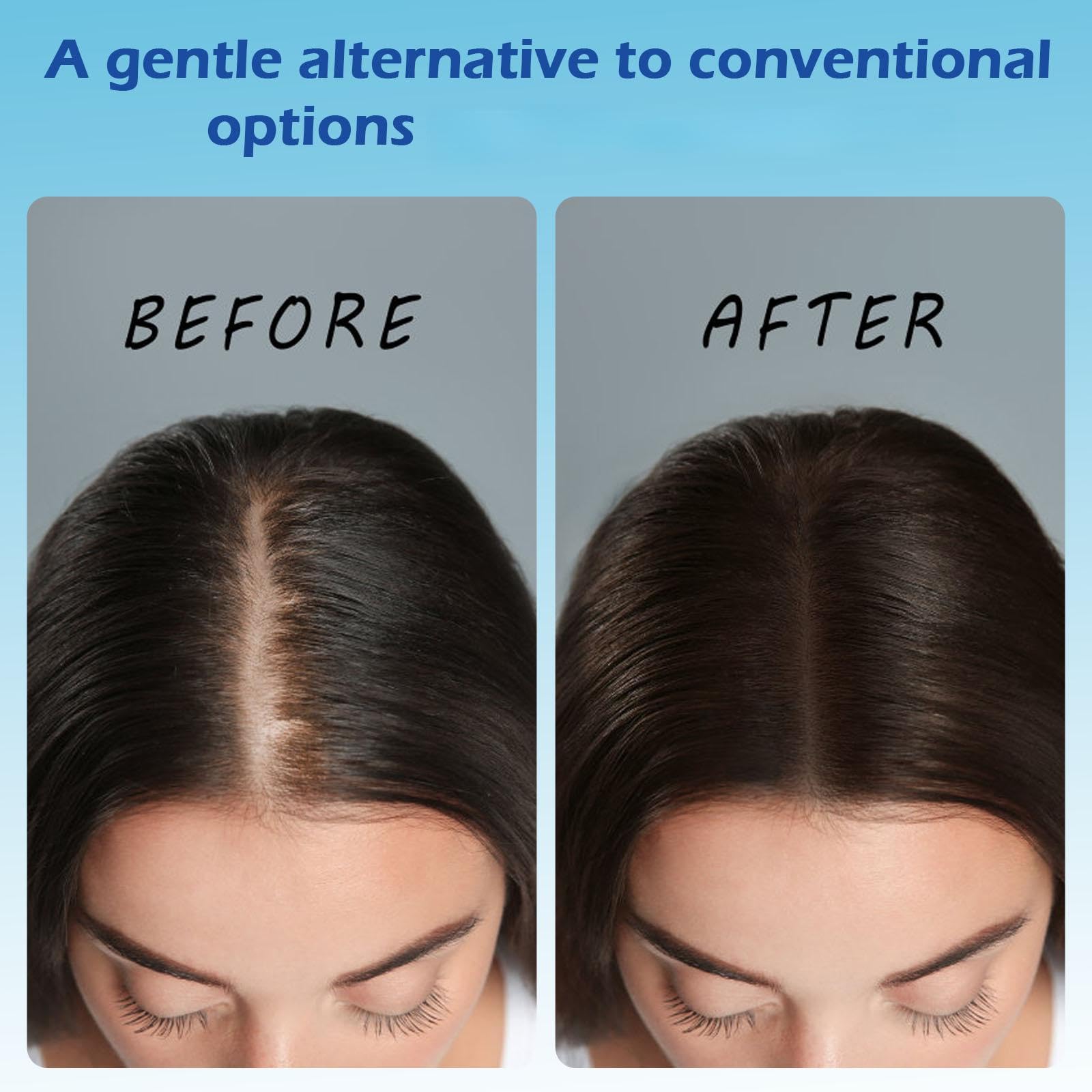 Close-up of roll-on applicator delivering targeted scalp treatment