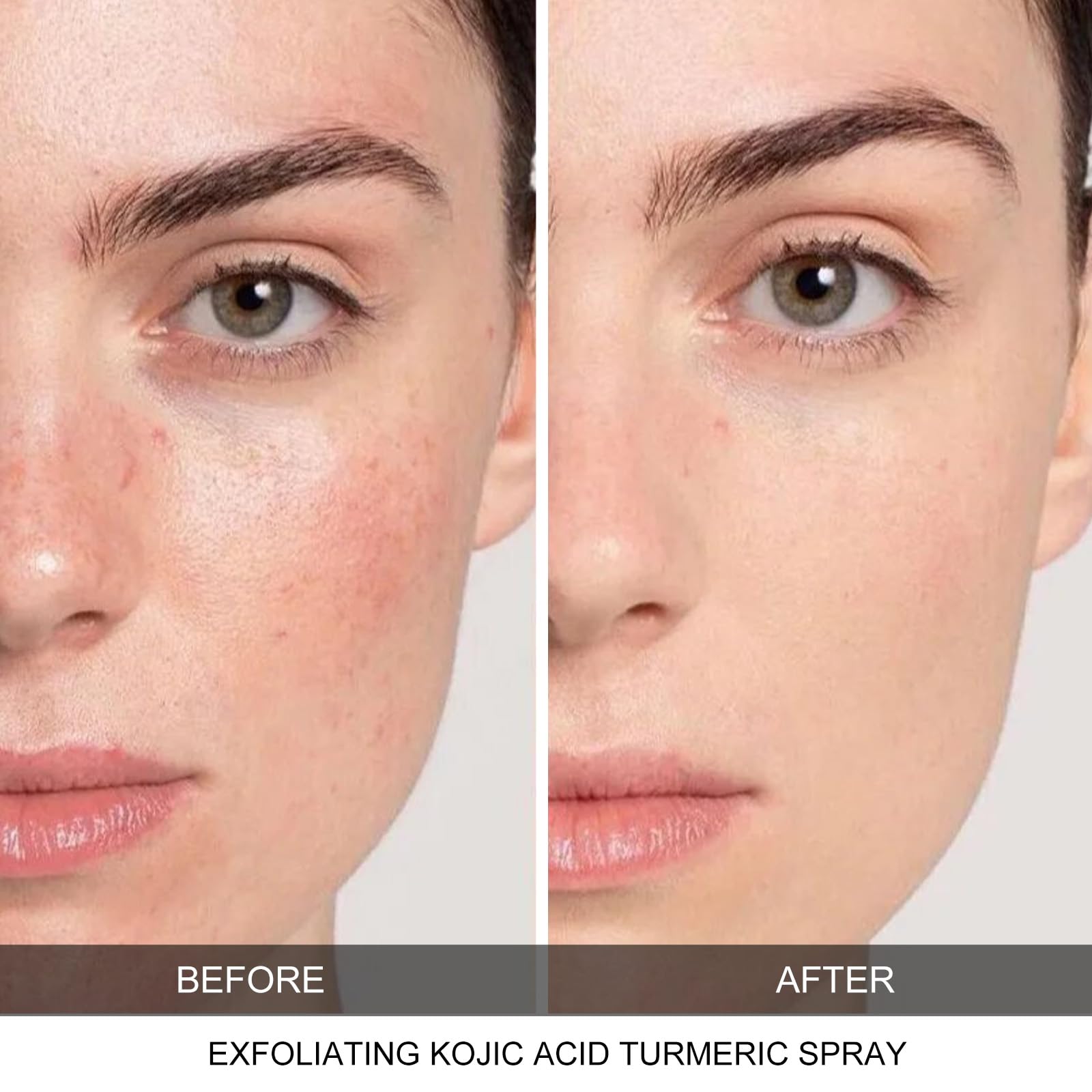 CHZHEN Keratin Care Kojic Turmeric Spray used on body for deep cleansing