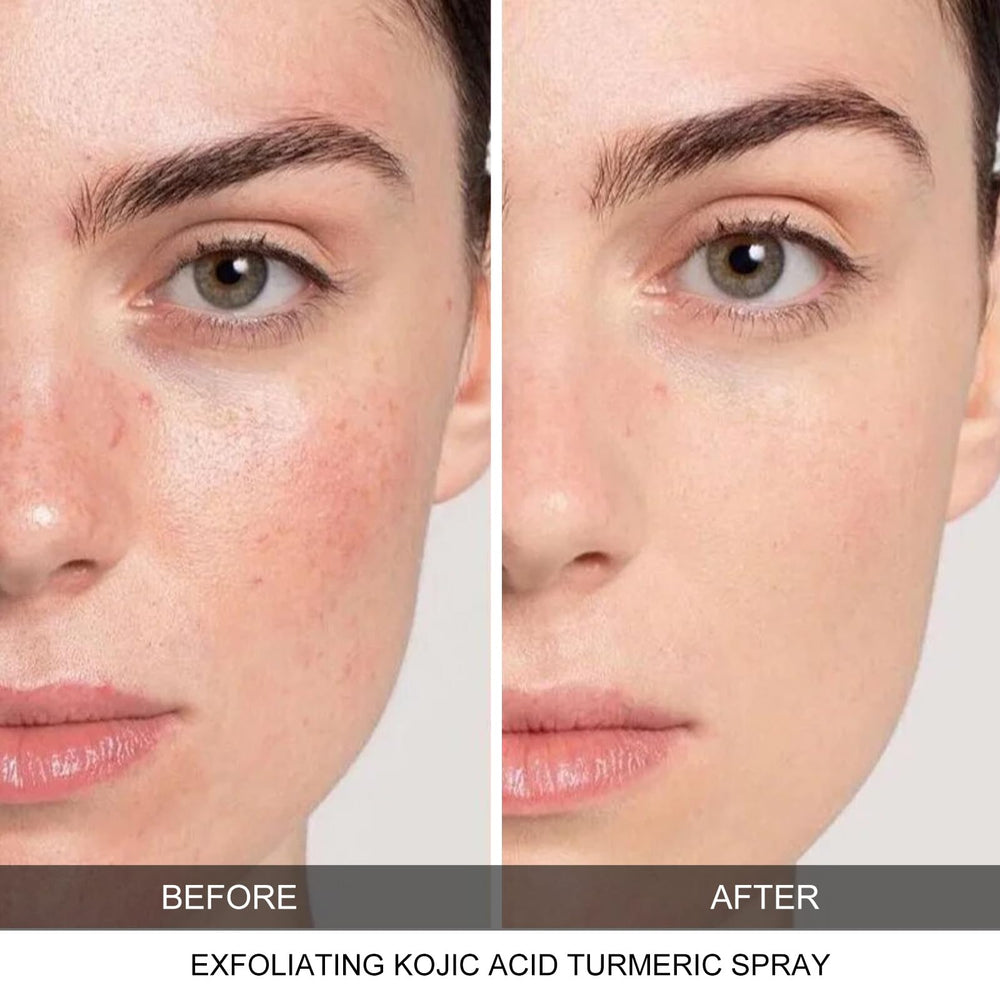 CHZHEN Keratin Care Kojic Turmeric Spray used on body for deep cleansing