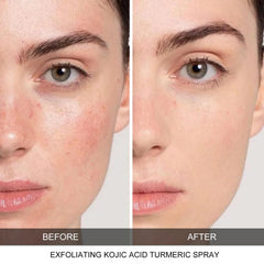CHZHEN Keratin Care Kojic Turmeric Spray used on body for deep cleansing