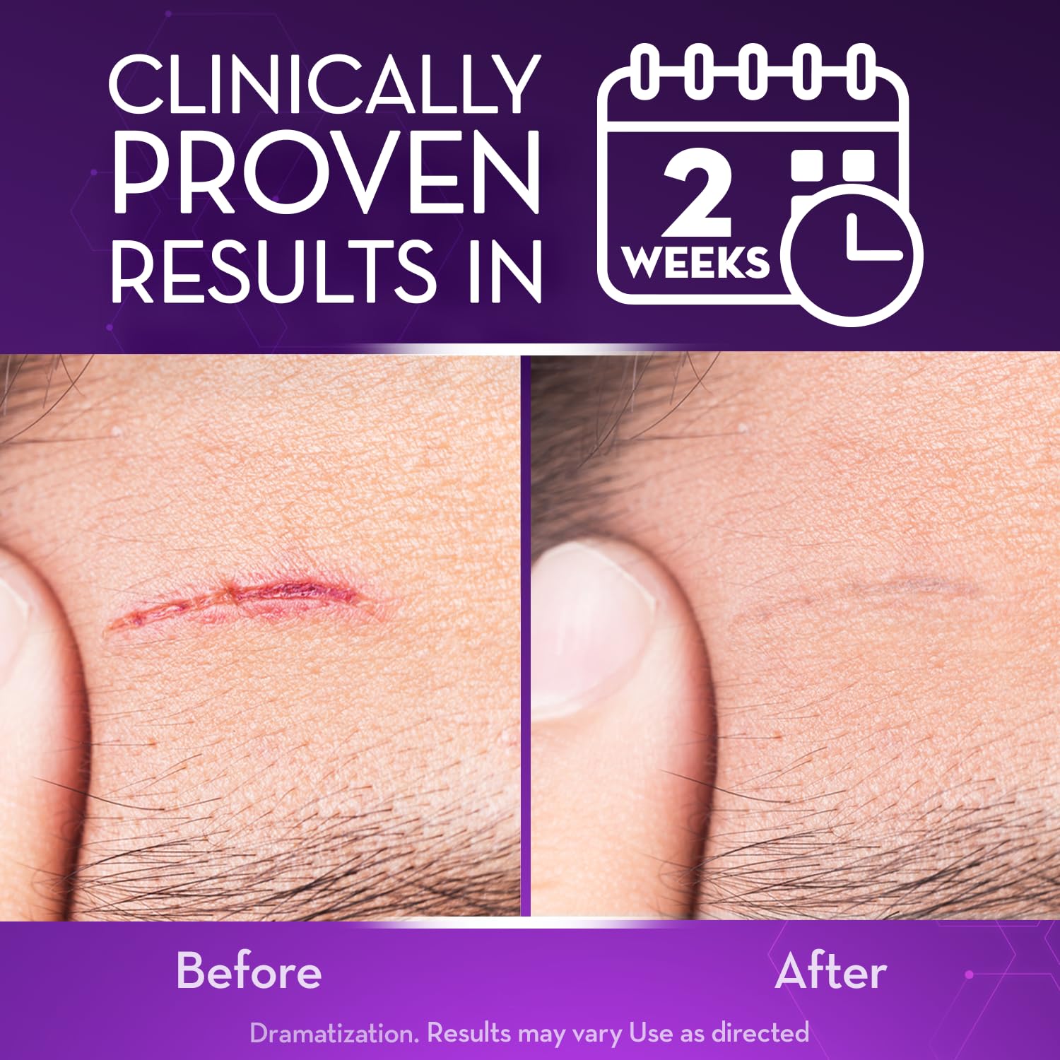Cicatricure Advanced Scar Gel application area on clean skin showing use.