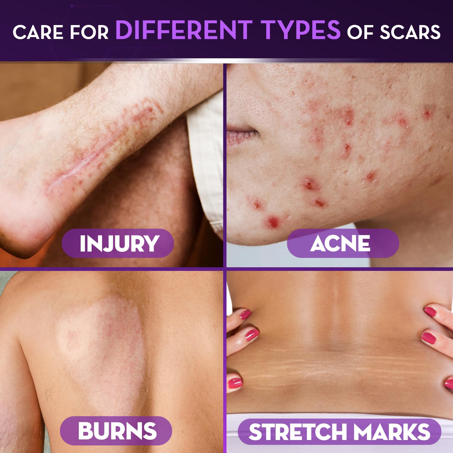 Cicatricure Advanced Scar Gel texture closeup reveals lightweight, non-greasy feel.