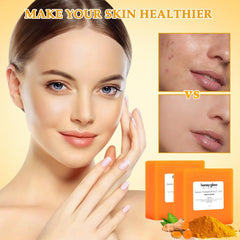 Cijikos Honey Glow Lemon Turmeric Kojic Soap Bar close-up reveals creamy lather and moisture.