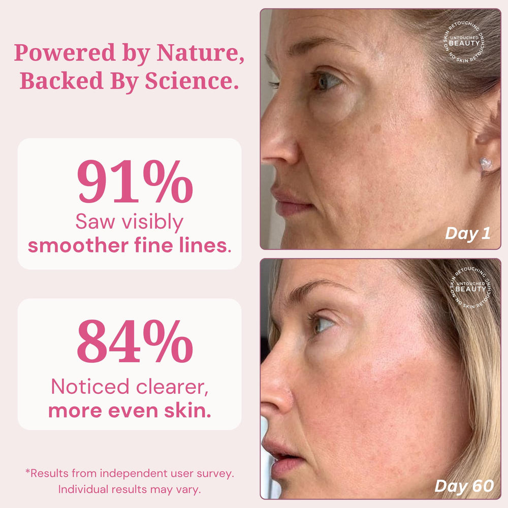 Cinder Brands Vegan PDRN Serum dropper in use for daily hydration